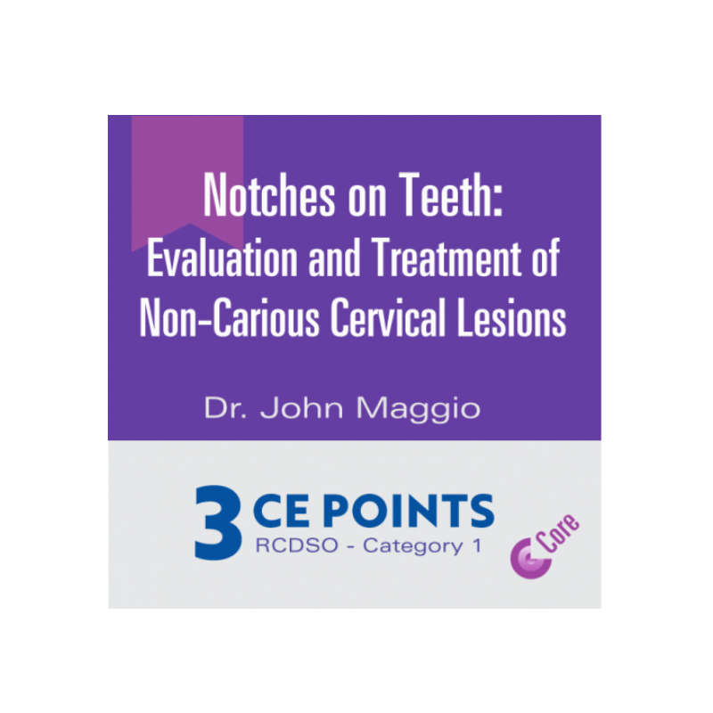 Notches on Teeth: Evaluation and Treatment of Non-Carious Cervical Lesions